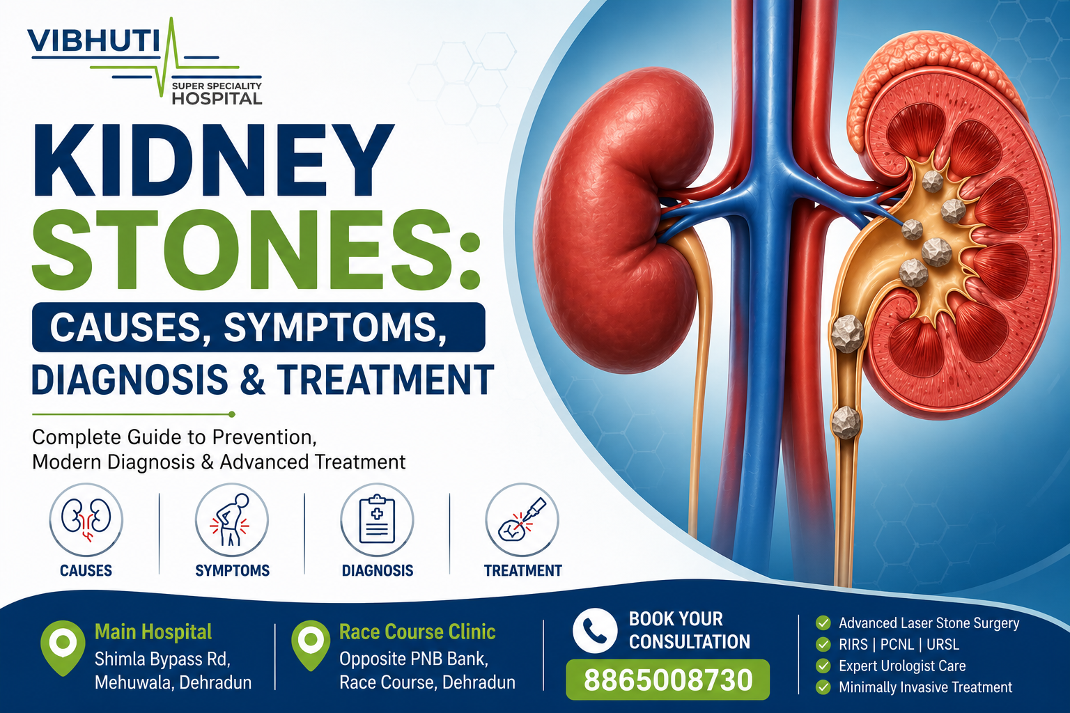 best kidney stone doctor in dehradun