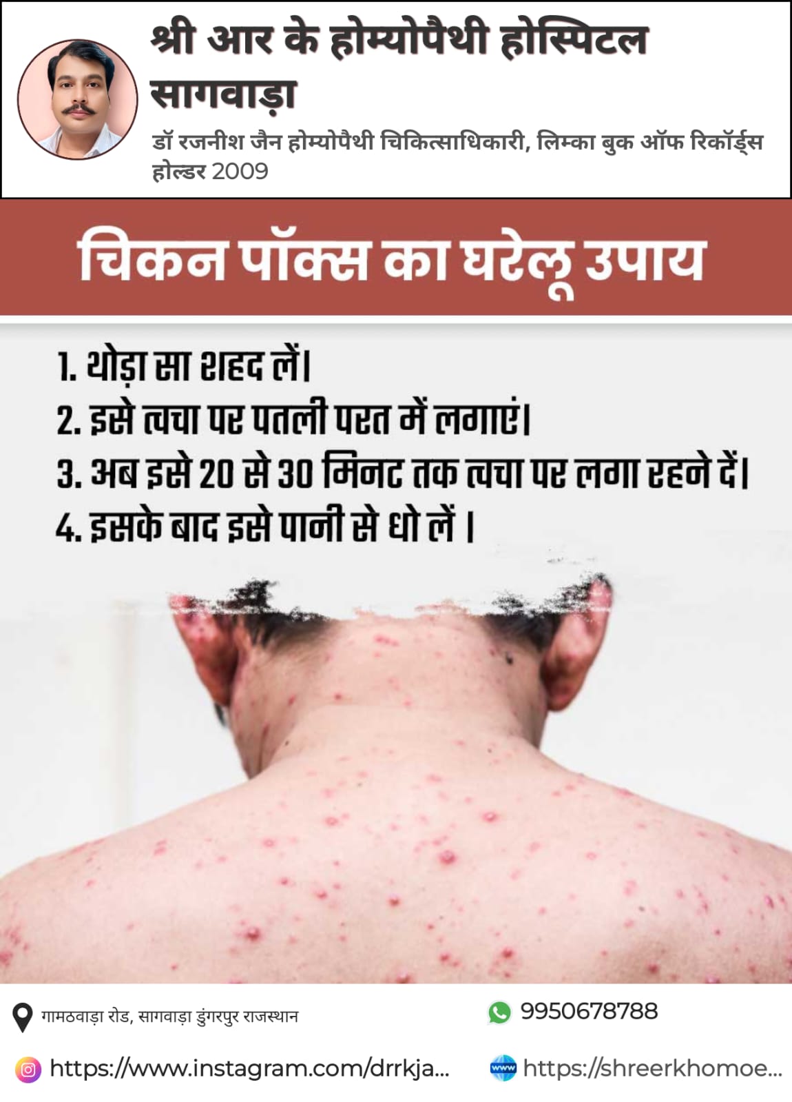 HEALTH TIPS TODAYS  LECODERMA