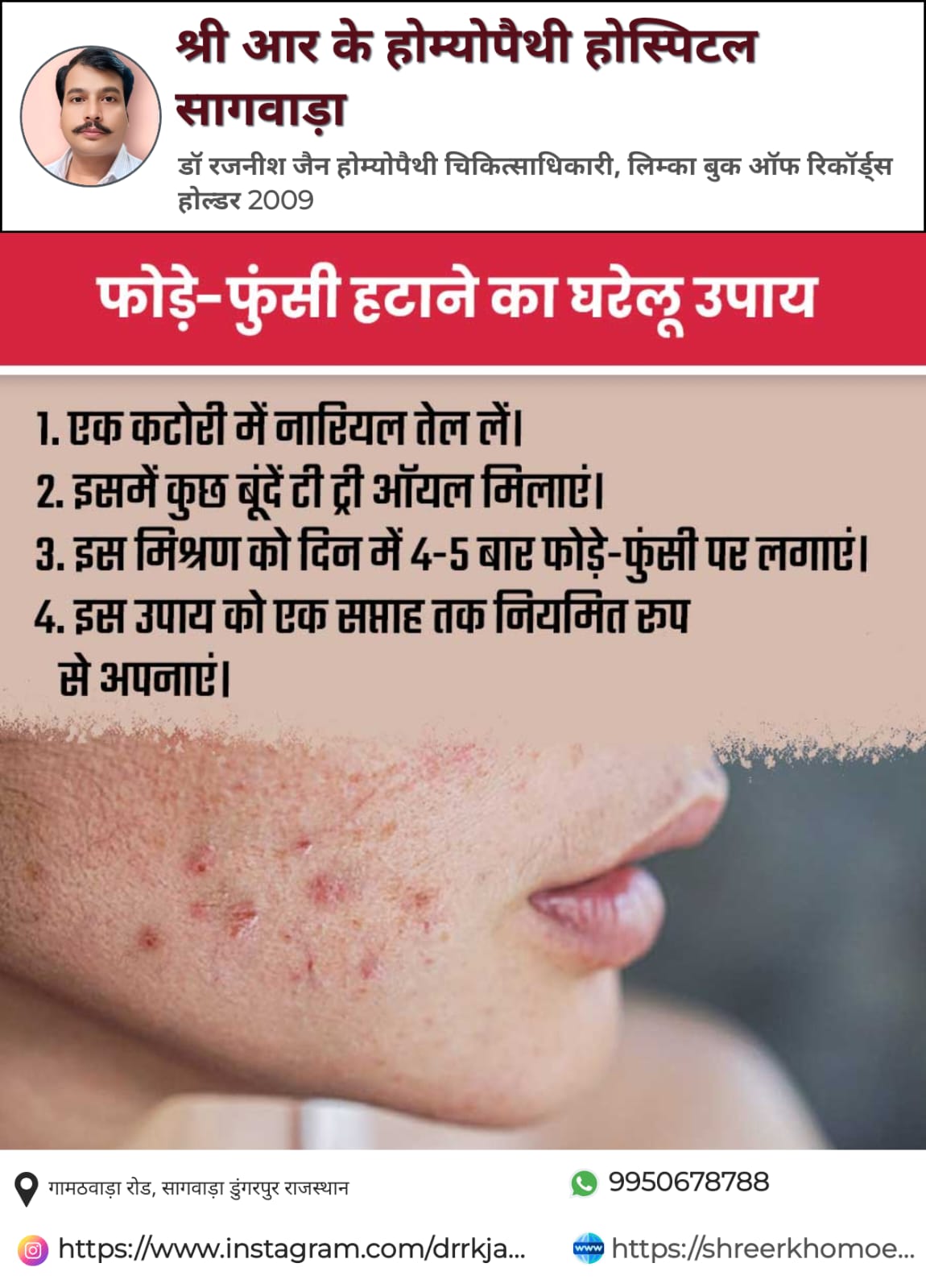HEALTH TIPS TODAYS 
