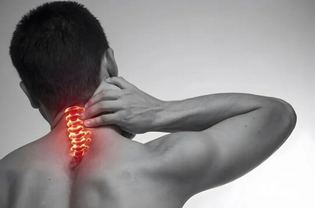 Cervical Spondylitis