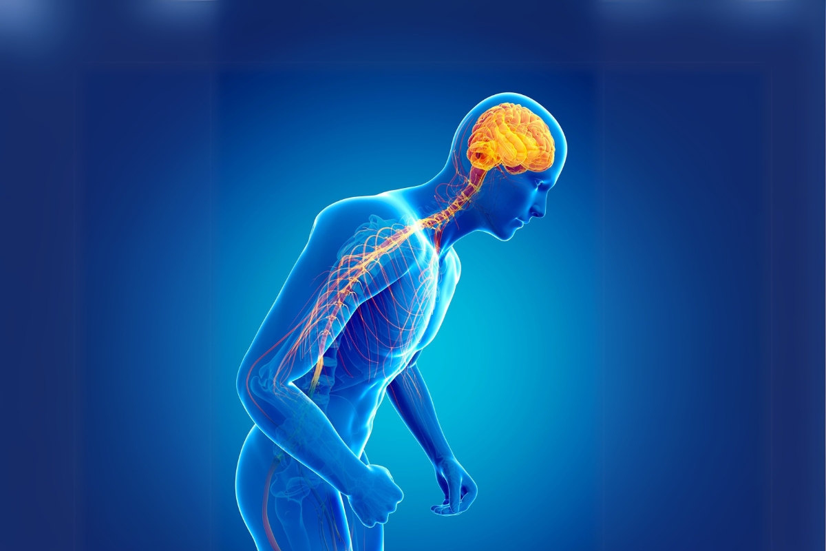 Parkinson’s Disease