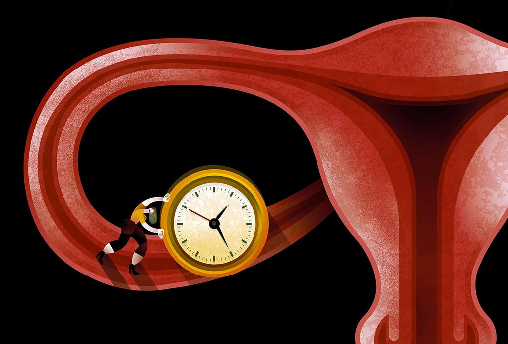 Menopause