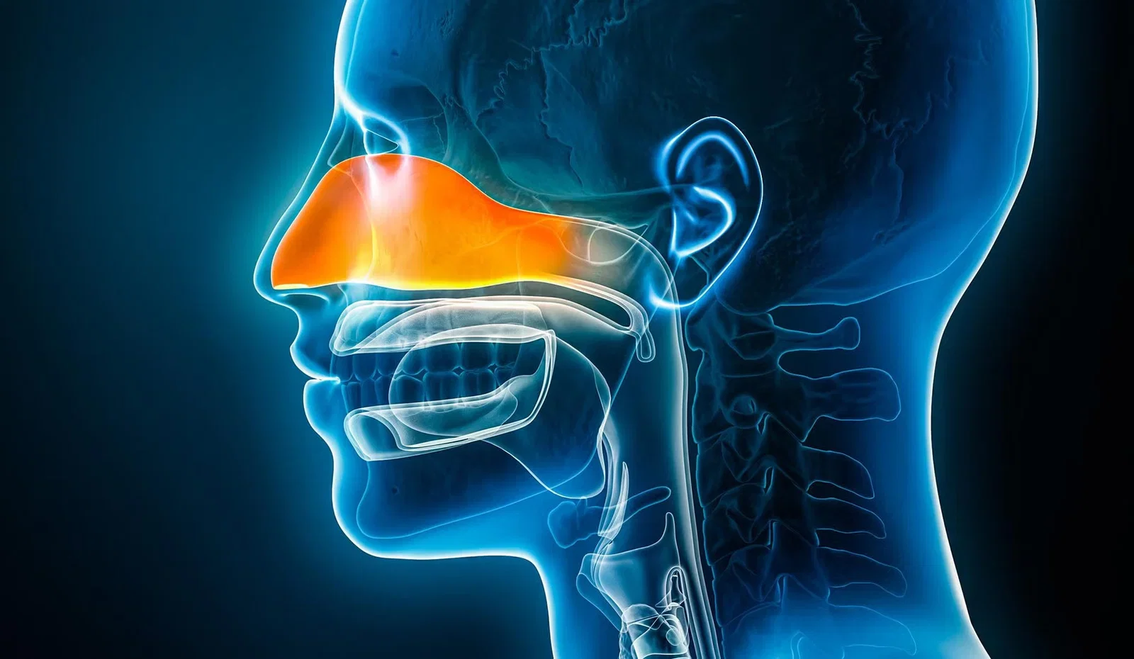 sinusitis